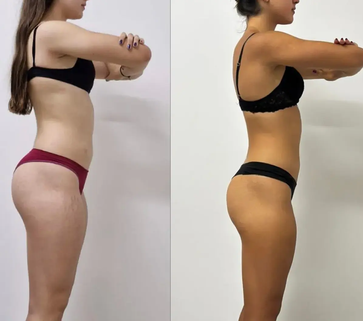 Resultado antes e depois