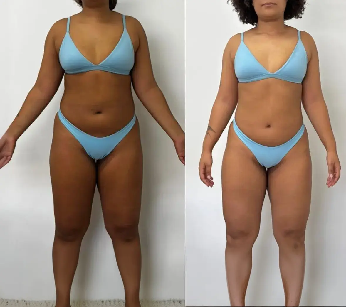 Resultado antes e depois