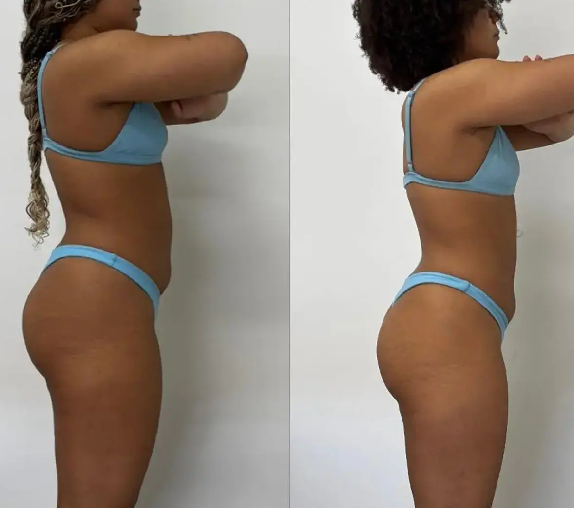 Resultado antes e depois