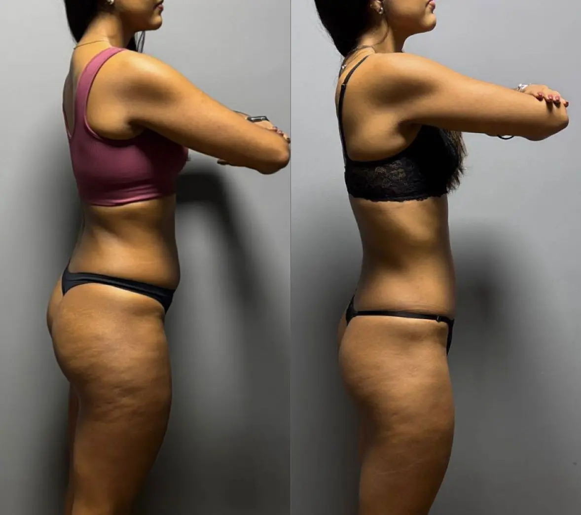 Resultado antes e depois