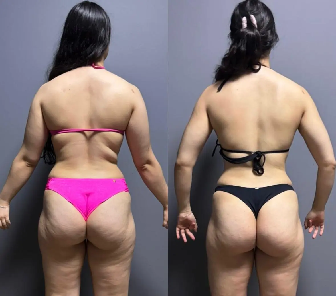 Resultado antes e depois