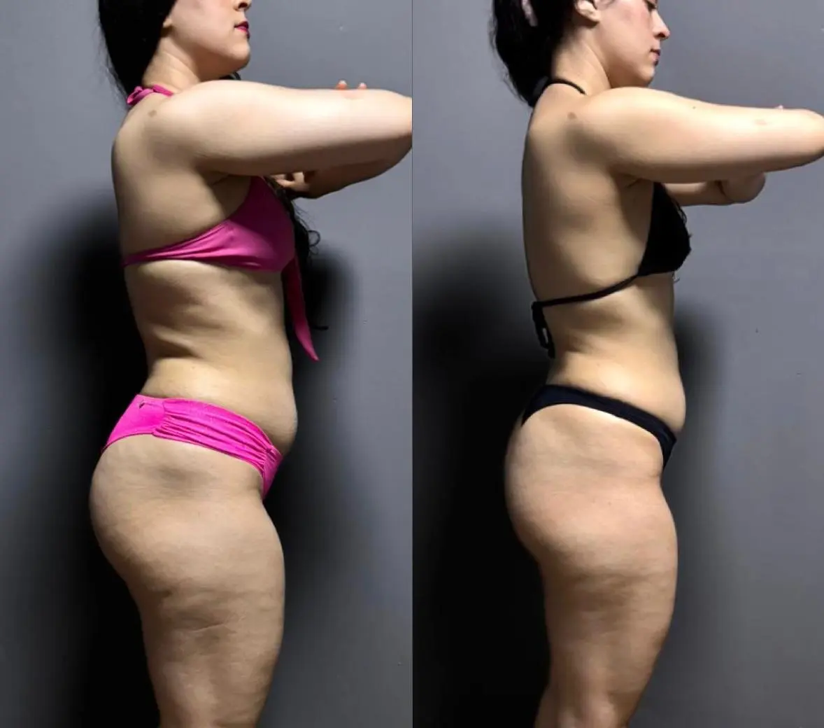 Resultado antes e depois