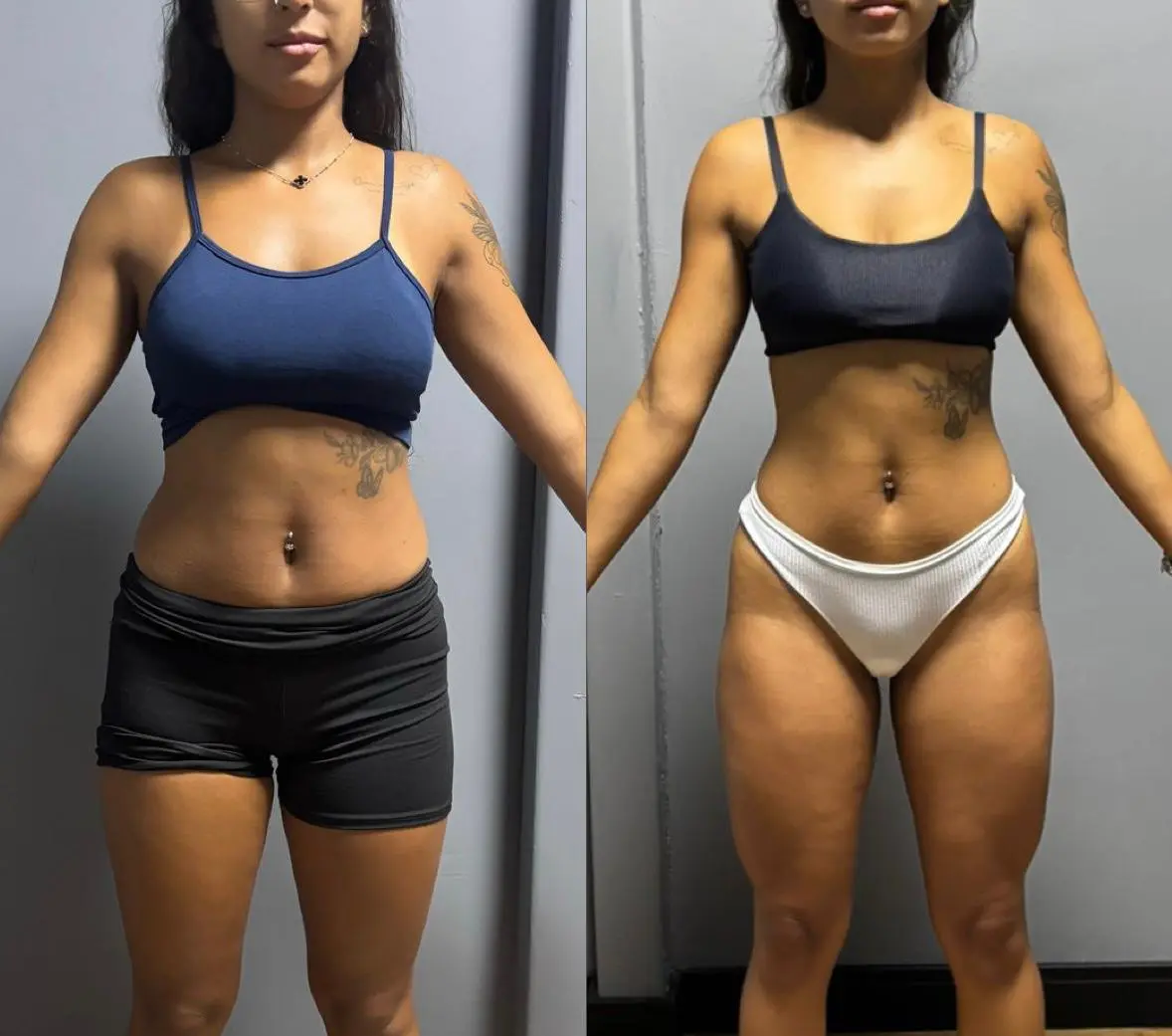 Resultado antes e depois