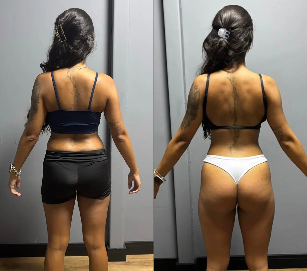 Resultado antes e depois