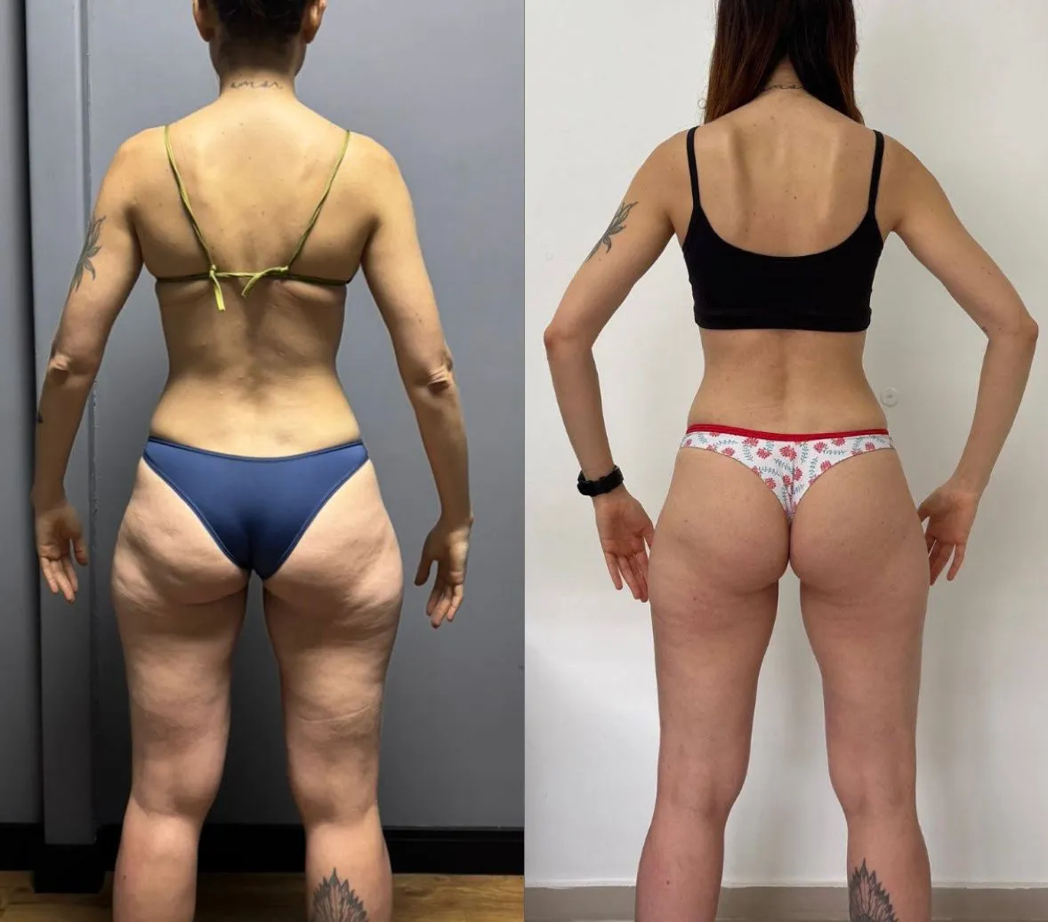 Resultado antes e depois